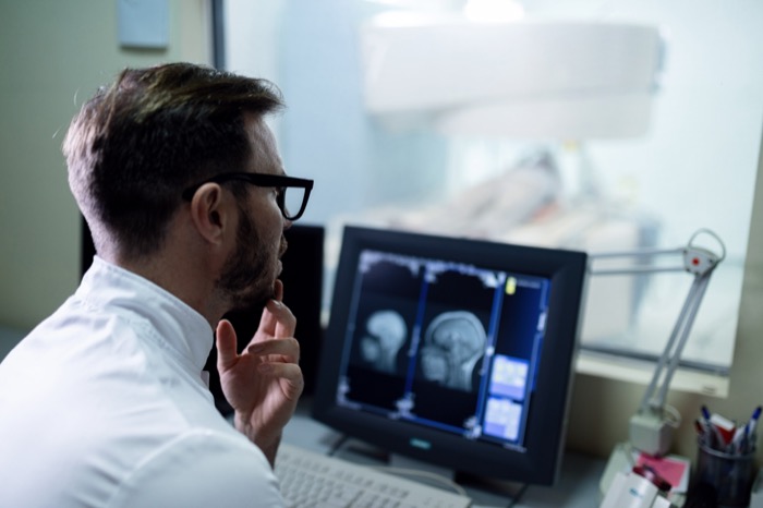 Doctor reviewing MRI results on monitor